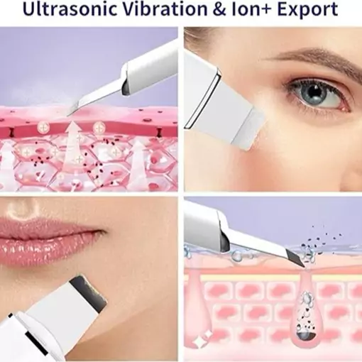 اسکرابر پوست ANLAN 2.0 اسکرابر اولتراسونیک صورت، پاکسازی صورت با 4 حالت